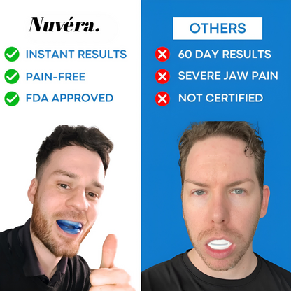 Nuvéra® Anti Snoring Mouthpiece